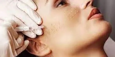 Biorevitalization treatment in nyc