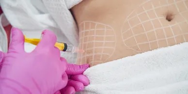 fat dissolving injections for body contouring