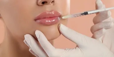 Aesthetician injecting dermal fillers for facial volume enhancemen